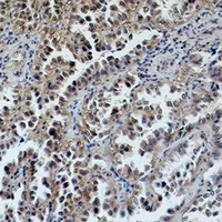 ERCC1 antibody