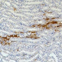 Fibronectin antibody