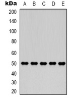 Fumarase Mouse Monoclonal Antibody