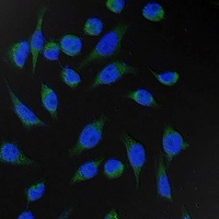 Fumarase Mouse Monoclonal Antibody