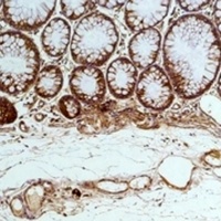 GRP78 Mouse Monoclonal Antibody