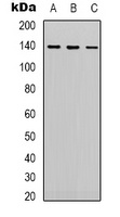 HER2 Mouse Monoclonal Antibody