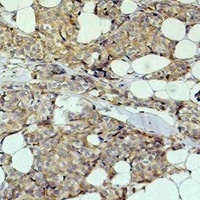 HER2 Mouse Monoclonal Antibody