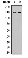 HER2 Mouse Monoclonal Antibody