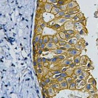 HER2 Mouse Monoclonal Antibody