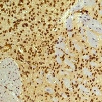 Anti-HIF1 beta Antibody