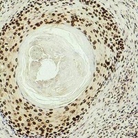 Anti-Histone H3 (DiMethyl-K27) Antibody