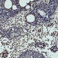 Histone H3 (DiMethyl-K36) Antibody