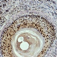 Histone H3 (DiMethyl-K9) Antibody