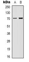 HSP70 Antibody