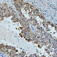 Anti-HSP70 Antibody