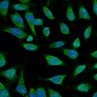 Anti-HSP70 Antibody