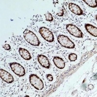 HSP90 alpha Antibody