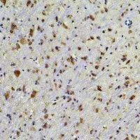 HSP90 beta Antibody