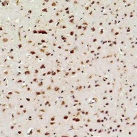 NF-kappaB p65 Antibody