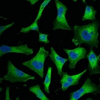 NF-kappaB p65 Antibody