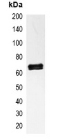 NF-kappaB p65 Antibody