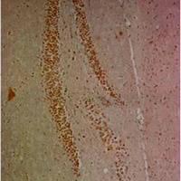 NF-kappaB p65 Antibody