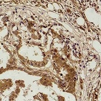Anti-Methyl-Lysine Antibody