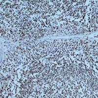 PARP1 Antibody