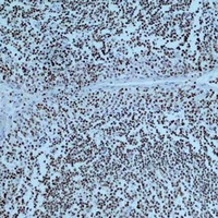 PARP1 antibody