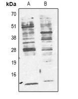 Phosphotyrosine Mouse Monoclonal Antibody