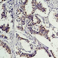 Anti-Phosphotyrosine Antibody