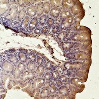 Smooth Muscle Actin Mouse Monoclonal Antibody