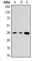 TBP Mouse Monoclonal Antibody