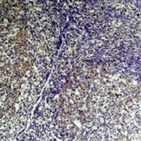 TNF alpha antibody