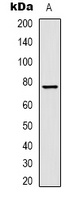 Transferrin Mouse Monoclonal Antibody