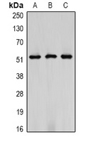 Vimentin Antibody