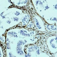 Anti-Vimentin Antibody