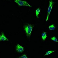 Anti-Vimentin Antibody