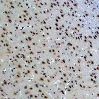 Anti-14-3-3 epsilon Antibody