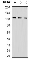 ACTN1 Rabbit Polyclonal Antibody