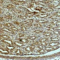 Anti-ACTN1 Antibody