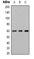 AKT1 Antibody