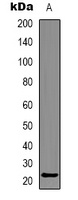 Alpha-crystallin C Rabbit Polyclonal Antibody