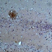 ASIC1 Antibody