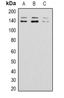 BAI1 Rabbit Polyclonal Antibody