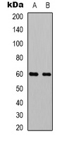 Beclin-1 Rabbit Polyclonal Antibody