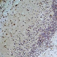 Anti-Bestrophin-1 Antibody
