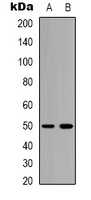 Bestrophin-2 Rabbit Polyclonal Antibody