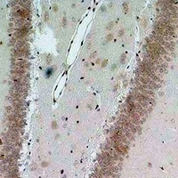 Anti-Bestrophin-2 Antibody