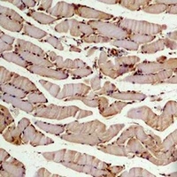 Anti-Beta2A-tubulin Antibody