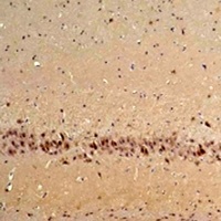 Anti-CABP1 Antibody