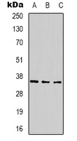 CABP2 Antibody