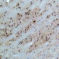 Anti-CACNB3 Antibody