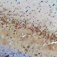 Anti-CACNG2 Antibody